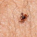 Photo Tick repellent